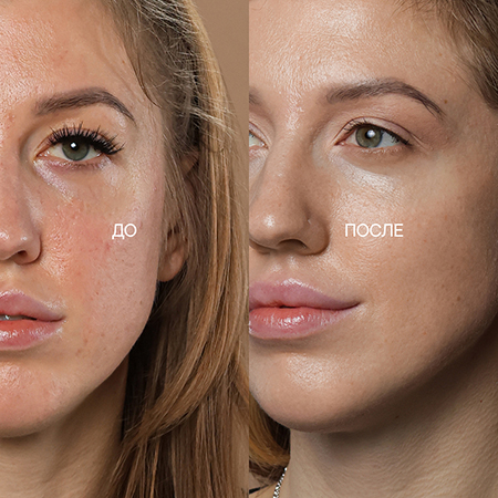 проблемы из-за неправильного домашнего ухода 